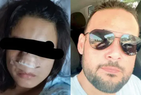 Excandidato de Veracruz agrede a mujer y le arranca la nariz tras intento de abuso Créditos: Especial 