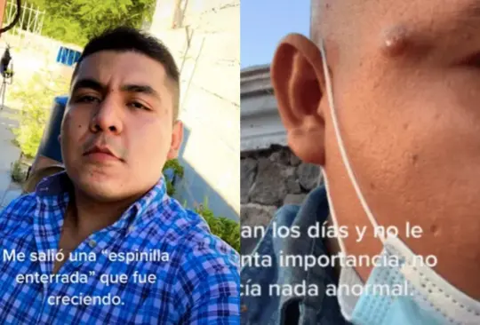 El joven aseguró que la erupción no parecía nada anormal  Créditos: TikTok/ @alonsocastg 