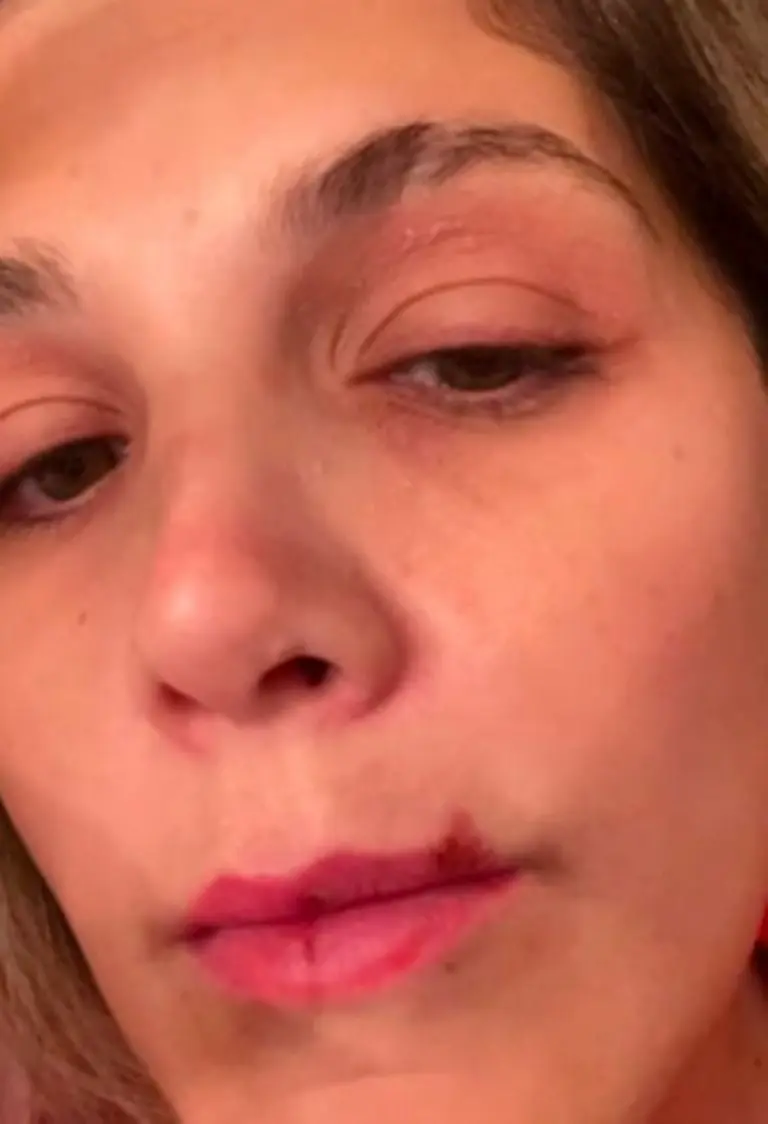 Natalia Alcocer mostró las agresiones que vivió a manos de su ex pareja Créditos: Instagram / @nataliaalcoceroficial