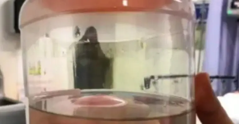 Médico cirujano capta extraña silueta en uno de los quirófanos de un hospital Créditos: Captura de pantalla