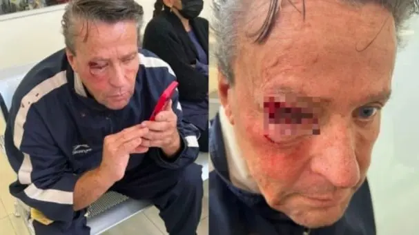 Alfredo Adame fue brutalmente golpeado afuera de su casa por unos ´malandros´ Créditos: Especial 