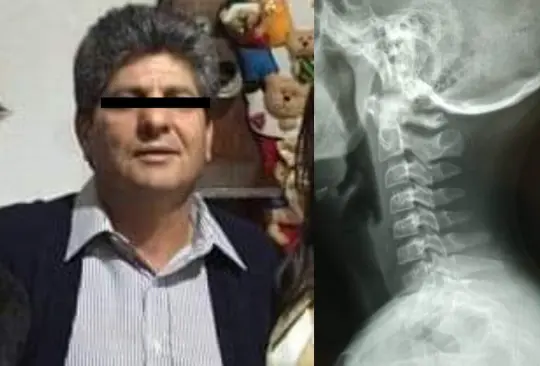 En Cuernavaca, Morelos un profesor estranguló a un alumno, quien resultó con lesión de columna vertebral