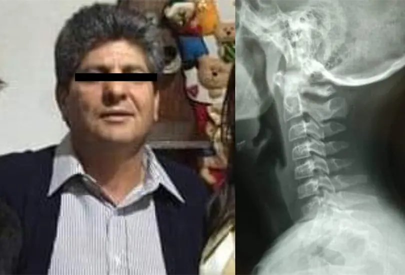 En Cuernavaca, Morelos un profesor estrangul&oacute; a un alumno, quien result&oacute; con lesi&oacute;n de columna vertebral