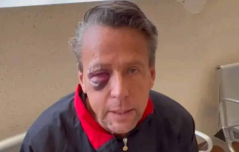 El actor Alfredo Adame revel&oacute; que tiene cuatro fracturas cerca del ojo Cr&eacute;ditos: Especial 