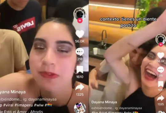 La influencer perdió su diente y comenzó a reírse para superar el vergonzoso momento La influencer perdió su diente y comenzó a reírse para superar el vergonzoso momento