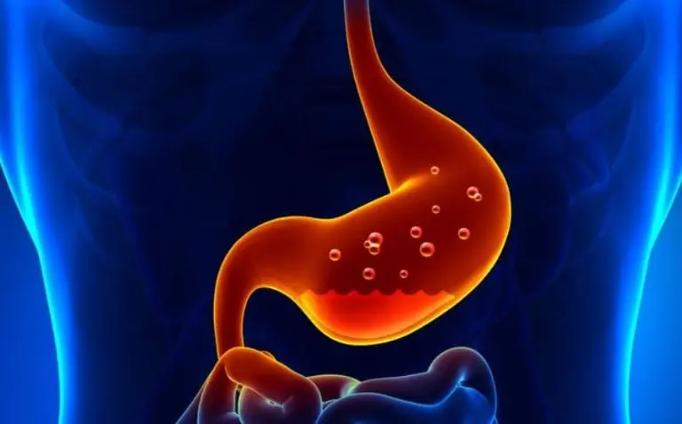 La gastritis provoca un dolor punzante en el estómago. Foto: asemi.org