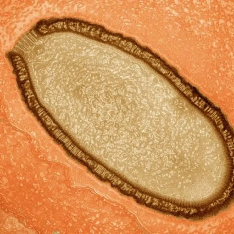 Resucitan virus zombis inactivos por 50,000 años: Riesgos emergentes Créditos: RS