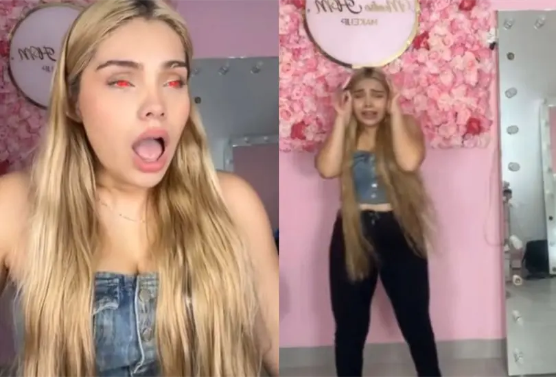 Tiktoker pierde la visión en transmisión en vivo tras ponerse pupilentes naranjas; pide ayuda Tiktoker pierde la visión en transmisión en vivo tras ponerse pupilentes naranjas; pide ayuda