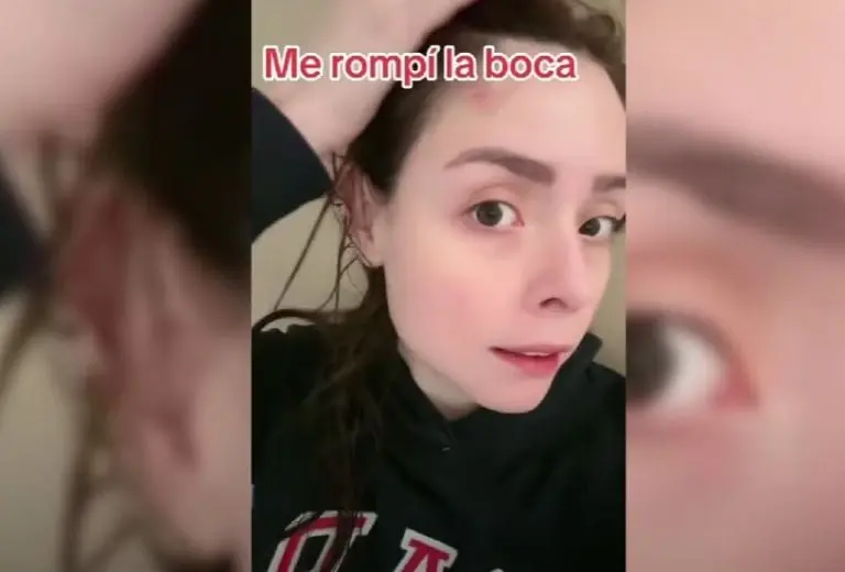 Maryfer Centeno sufre aparatosa caída (YouTube)