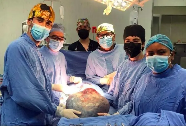Retiran a una mujer un tumor de 21 kilos en Guanajuato Créditos: IMSS