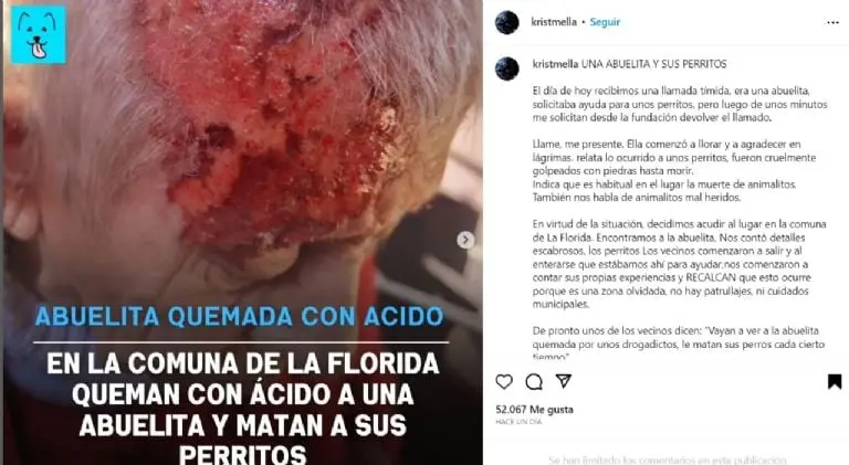 Sujetos atacan a abuelita con ácido - Tomada de video
