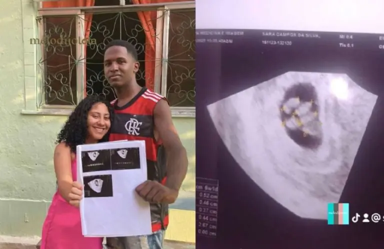 ¡Embarazada de quintillizas! Joven de 18 Años se lleva sorpresa en ultrasonido y conquista las redes Créditos: X (Twitter)