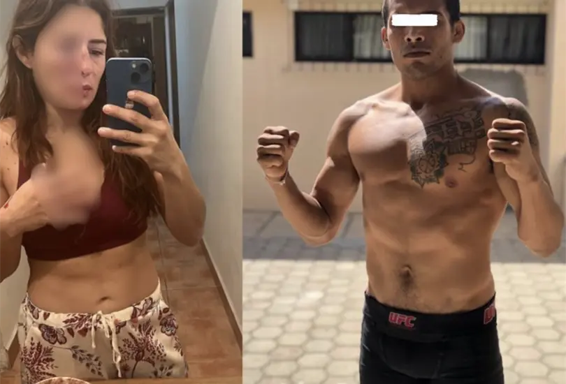 &acute;Nunca pens&eacute; que esto me fuera a pasar a m&iacute;&acute;: La luchadora Daniela L&oacute;pez denuncia brutal agresi&oacute;n