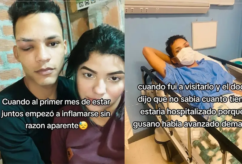Hombre termina con gusano en ojo por comer carne de cerdo Hombre termina con gusano en ojo por comer carne de cerdo