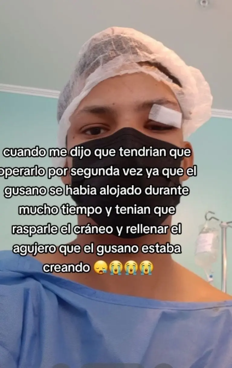 Hombre termina con gusano en el ojo - Tomada de video
