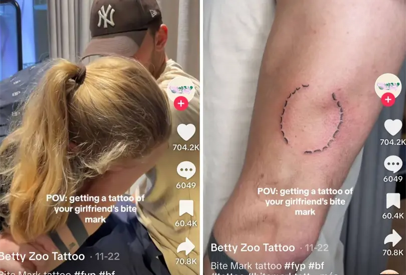 Joven pide el tatuaje de la mordida de su novia 