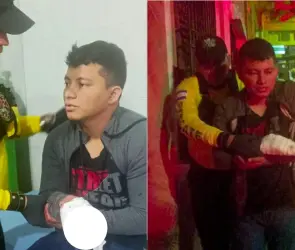 Conoce la historia de Jesús, el joven que perdió los dedos por pirotecnia en Navidad