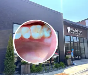Dentista desfigura a mujer: le hizo 8 coronas, 4 endodoncias y 20 empastes en una sola consulta