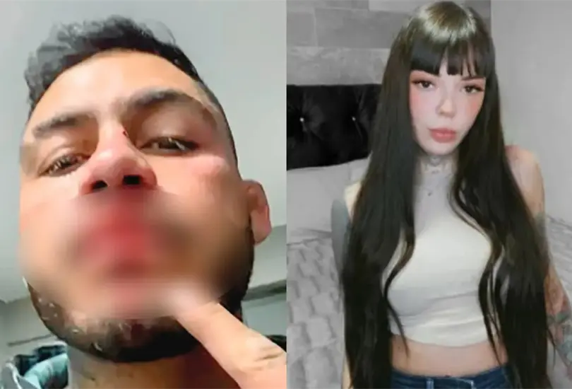 Marc&oacute; Beltr&aacute;n, peleador mexicano y ex participante de Exatl&oacute;n, denuncia a su exnovia por agresi&oacute;n. 