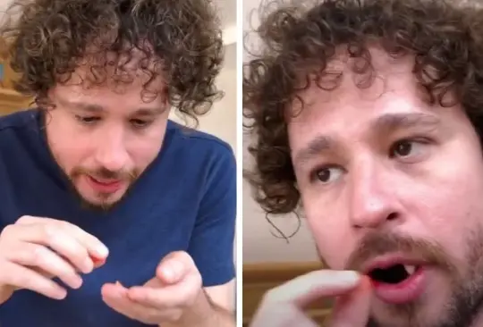 Luisito Comunica pierde sus dientes Luisito Comunica pierde sus dientes