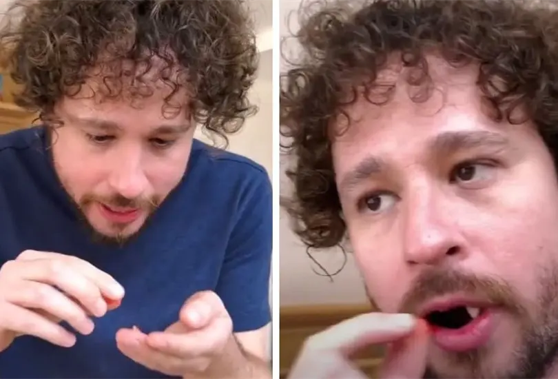 Luisito Comunica pierde sus dientes Luisito Comunica pierde sus dientes
