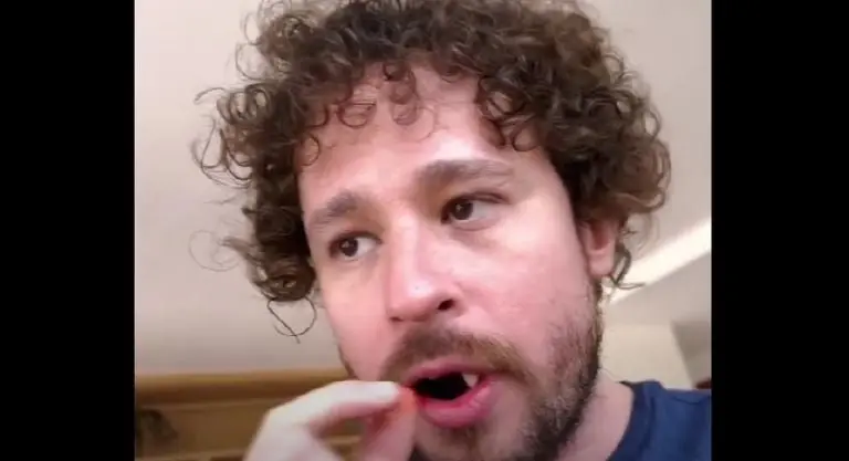 Luisito Comunica pierde sus dientes (YouTube)