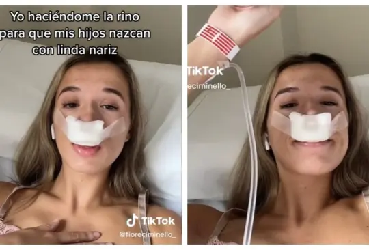 Influencer se hace rinoplastia para que la hereden sus hijos 