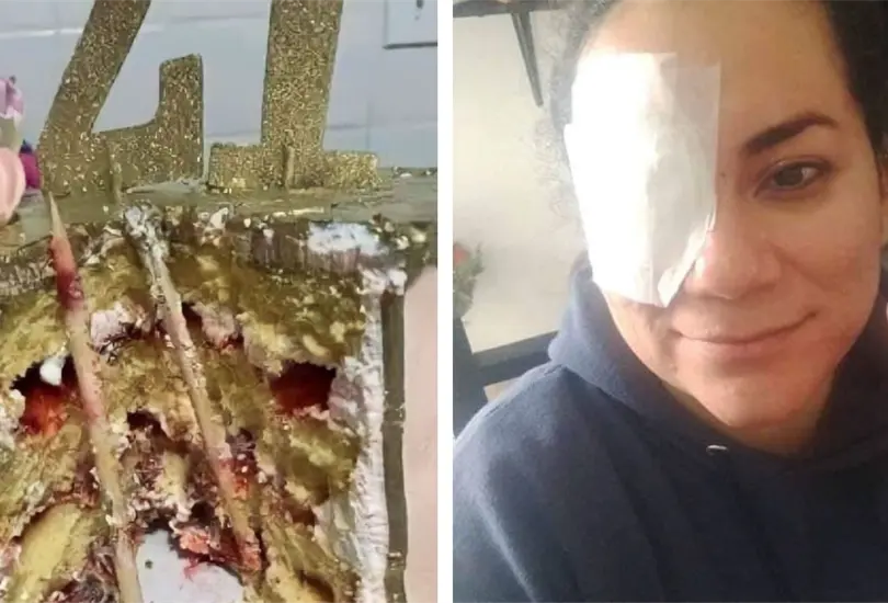 Festejada casi pierde ojo al morder su pastel Festejada casi pierde ojo al morder su pastel