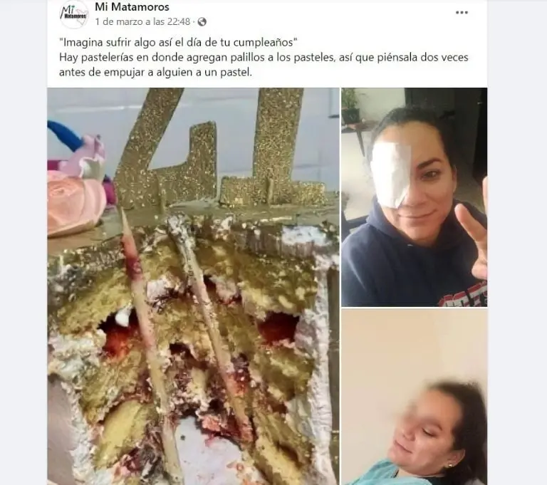 Mujer casi pierde ojo al morderle a pastel (Facebook)