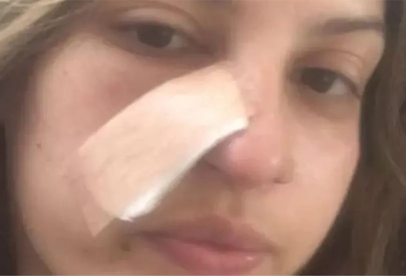 Joven descubre c&aacute;ncer gracias a limpieza facial. 