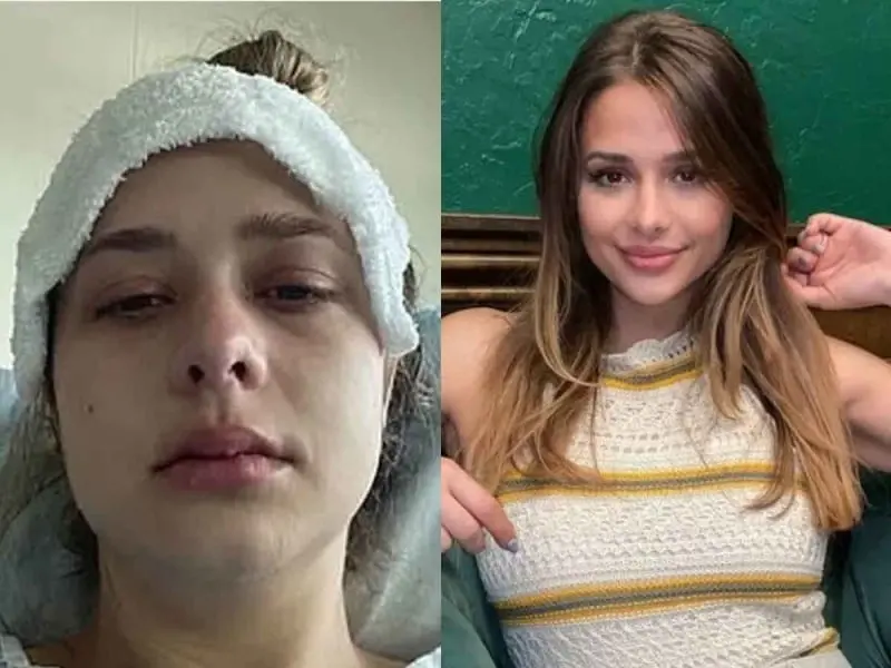 Joven va al doctor porque eructaba mucho y recibe diagn&oacute;stico devastador