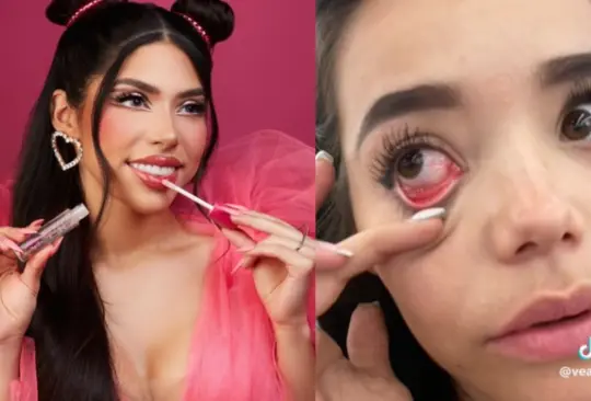 Joven denuncia que maquillaje de Yeri Mua le causó alergia y la influencer responde