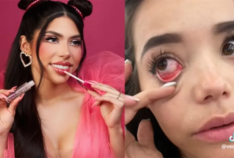 Joven denuncia que maquillaje de Yeri Mua le caus&oacute; alergia y la influencer responde