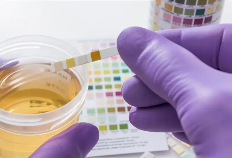 ¿Por qué el vinagre sirve para limpiar casi todo? Esto dice la Ciencia. ¿Por qué el vinagre sirve para limpiar casi todo? Esto dice la Ciencia.
