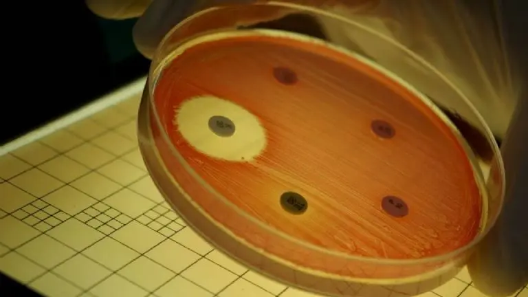 El antibiótico RS102895 o abaucina ataca directo a las superbacterias. Créditos: Canva