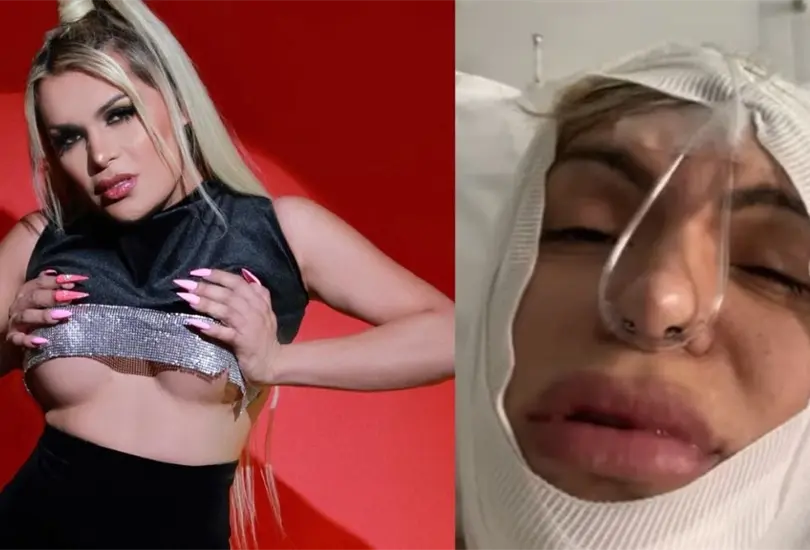 Wendy Guevara antes y después de sus cirugías estéticas. Wendy Guevara antes y después de sus cirugías estéticas.