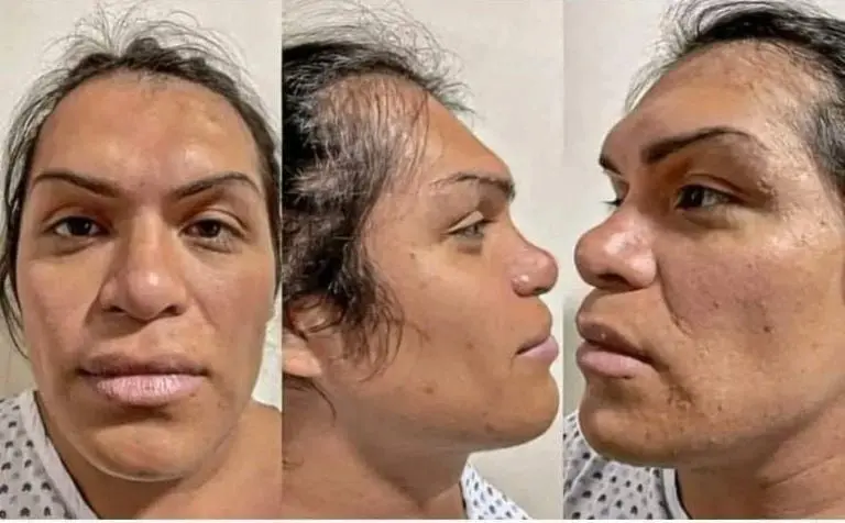 Wendy Guevara antes de sus cirugías estéticas y sin maquillaje. Foto: Twitter