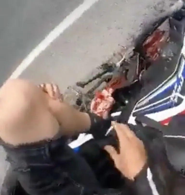 Motociclista pierde la pierna por querer adelantar un camión en la carretera. Foto: Twitter