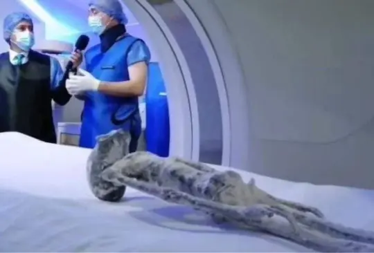 VIDEO: Realizan Rayos X a cuerpos extraterrestres de Jaime Maussan y le dan la razón. 