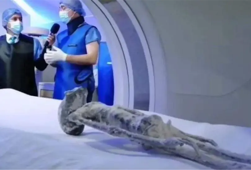 VIDEO: Realizan Rayos X a cuerpos extraterrestres de Jaime Maussan y le dan la raz&oacute;n. 