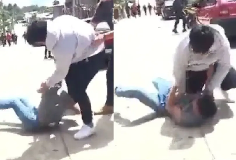 Estudiante le rompe el brazo a su compañero durante pelea en Chiapas. Estudiante le rompe el brazo a su compañero durante pelea en Chiapas.