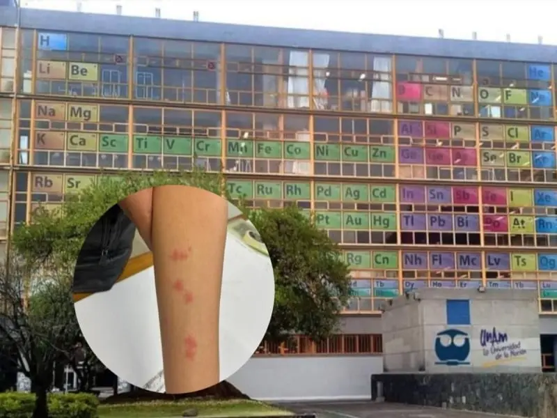 Suspenden clases en la UNAM por plaga de chinches. 