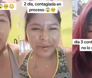 “Me doy asco”: Joven con viruela del mono narra cómo es tener esta enfermedad