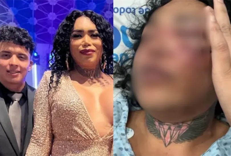 Su novio la golpe&oacute;: Paola Su&aacute;rez de las Perdidas es hospitalizada de emergencia tras recibir anillo de compromiso