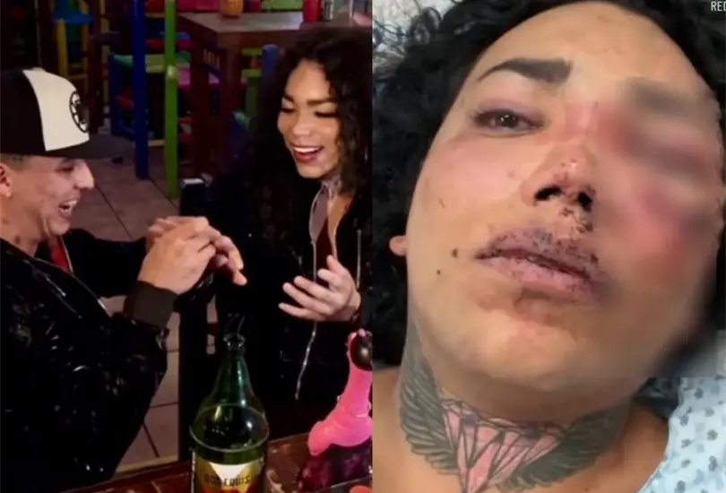 Paola Su&aacute;rez, de Las Perdidas est&aacute; a punto de perder uno de sus ojos. 