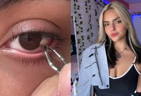 Influencer Yanei Reach causa polémica en TikTok al mostrar cómo se depila el ojo