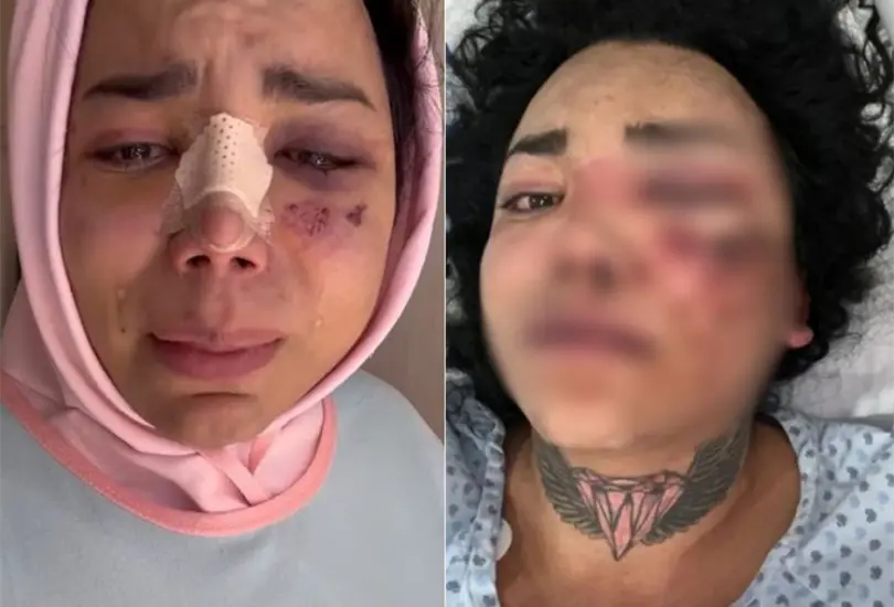 Paola Su&aacute;rez de Las Perdidas rompe el silencio tras brutal golpiza de su novio. 