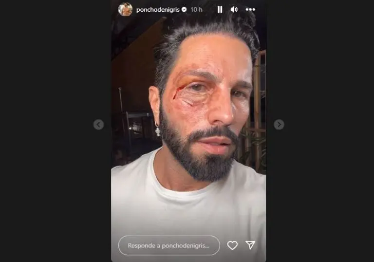 Poncho de Nigris golpeado. Foto: Instagram.