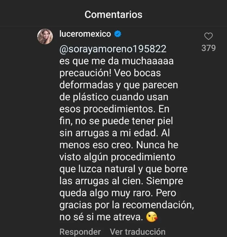Lucero rechaza el bótox (Instagram)