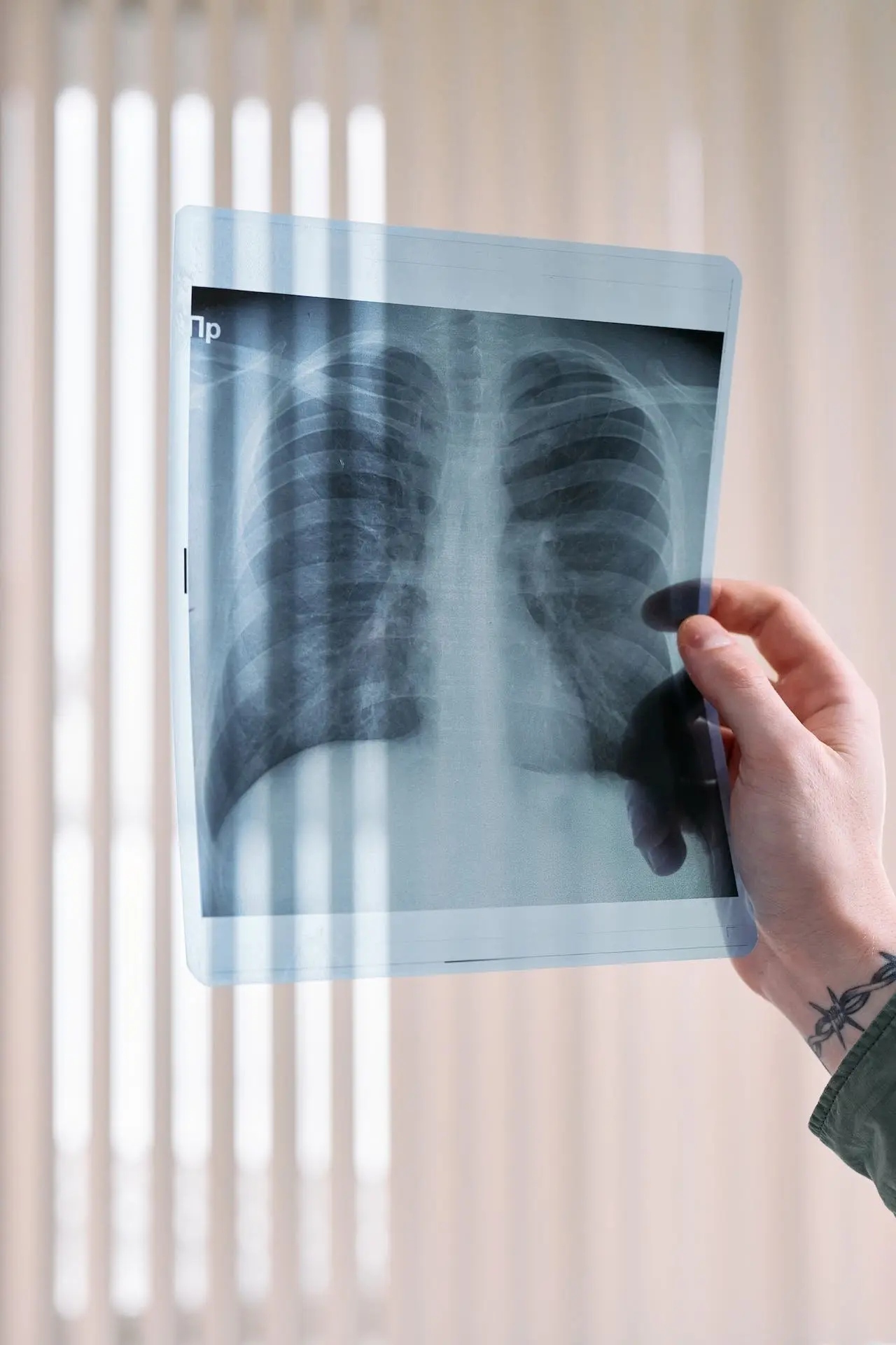 9. Enfermedades pulmonares obstructivas cr&oacute;nicas
